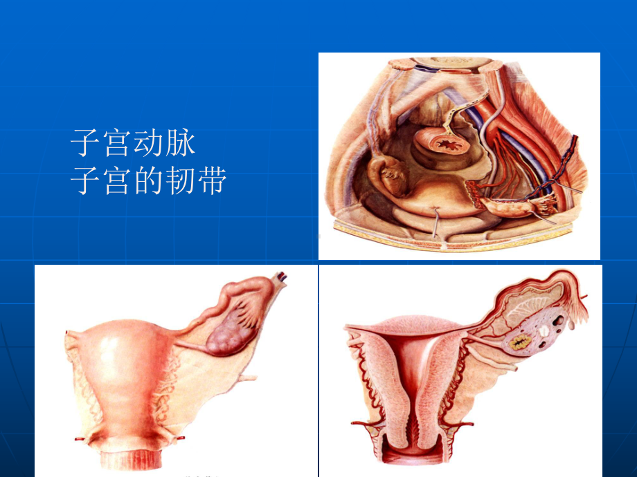 阴式子宫次全切除术病例手术解析课件.ppt_第3页