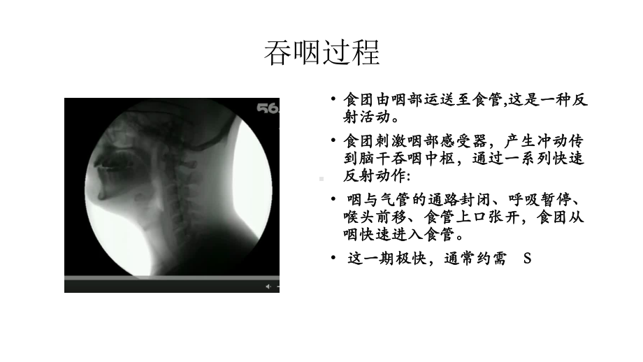 上消化道异物的处理课件.ppt_第2页