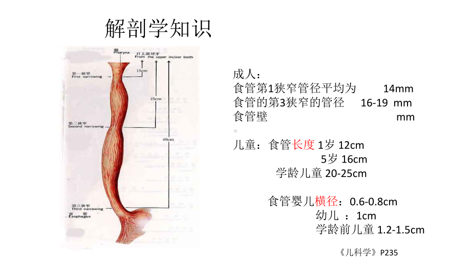 上消化道异物的处理课件.ppt_第3页