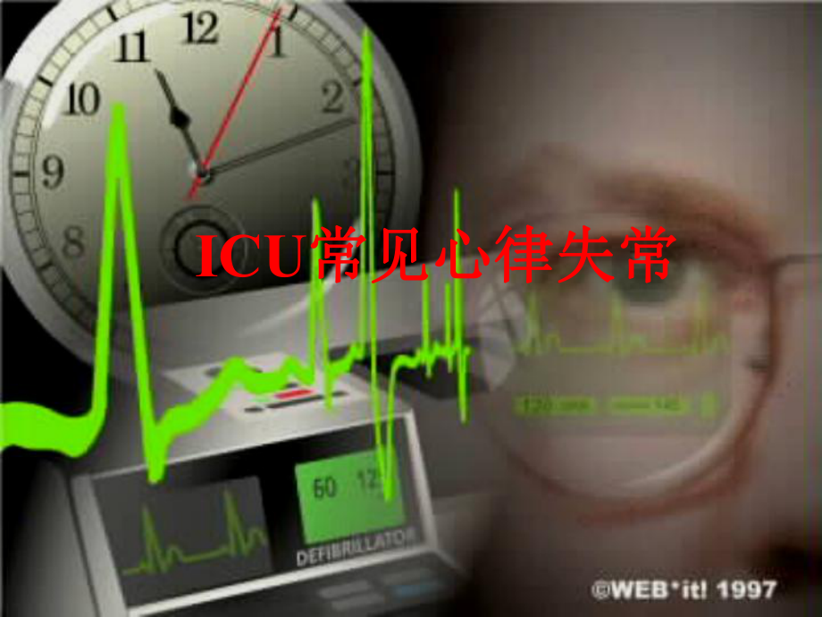 ICU常见之心律失常课件.ppt_第1页