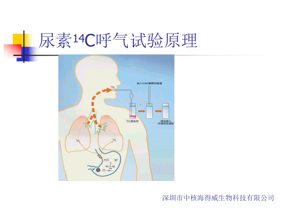 C呼气试验及其安全性课件.ppt_第3页