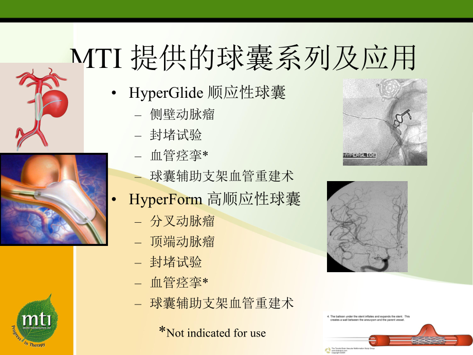 MTI球囊用法及用途课件.ppt_第2页