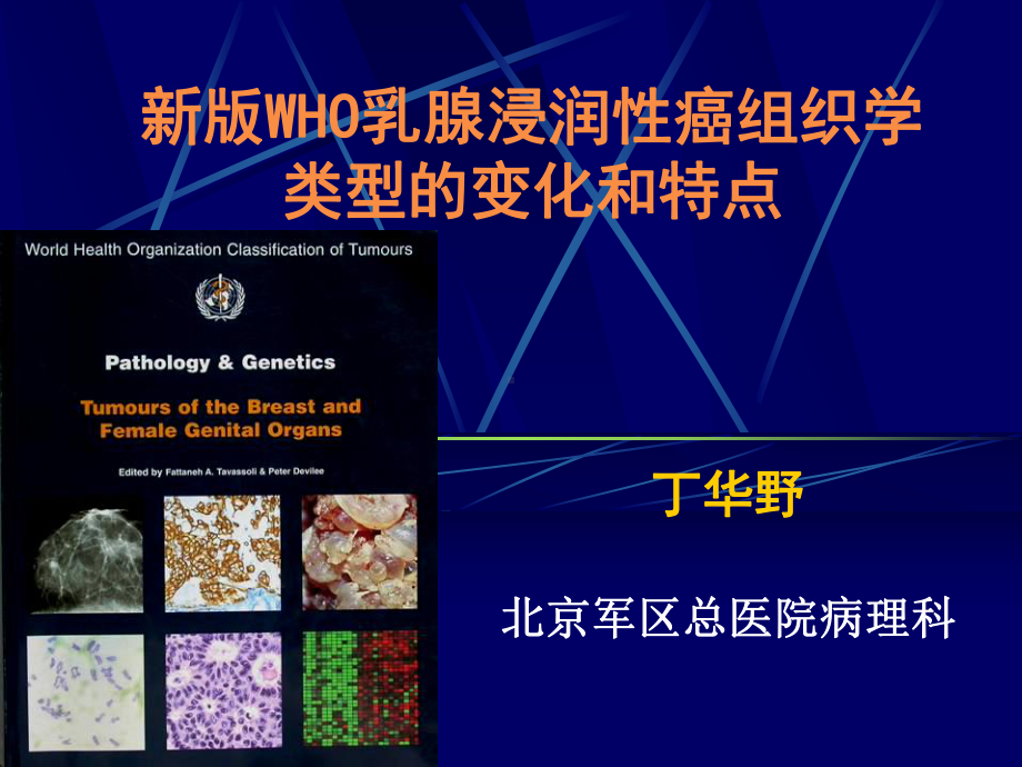 x新版WHO乳腺-课件.ppt_第1页