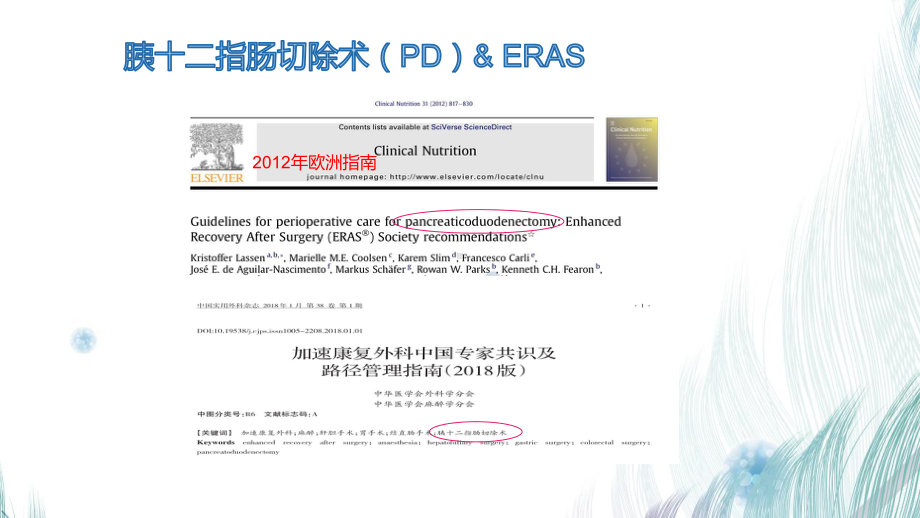 ERAS在腹腔镜胰十二指肠切除术的体会课件.pptx_第3页