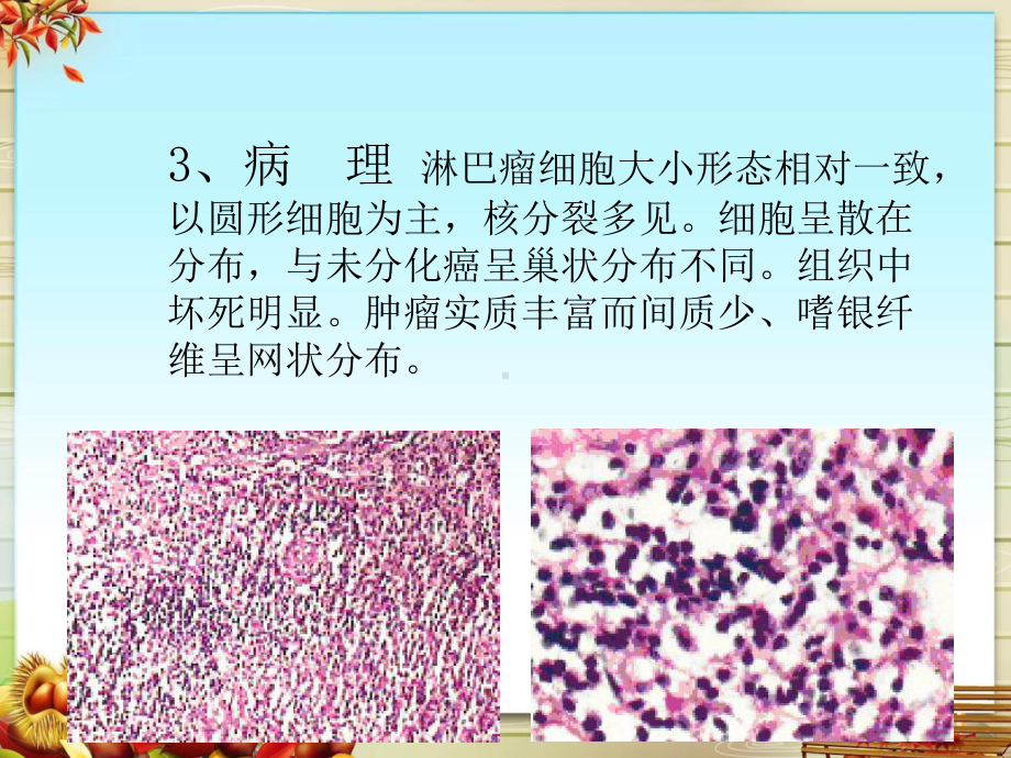 鼻咽部肿瘤的CT诊断和鉴别课件.pptx_第3页