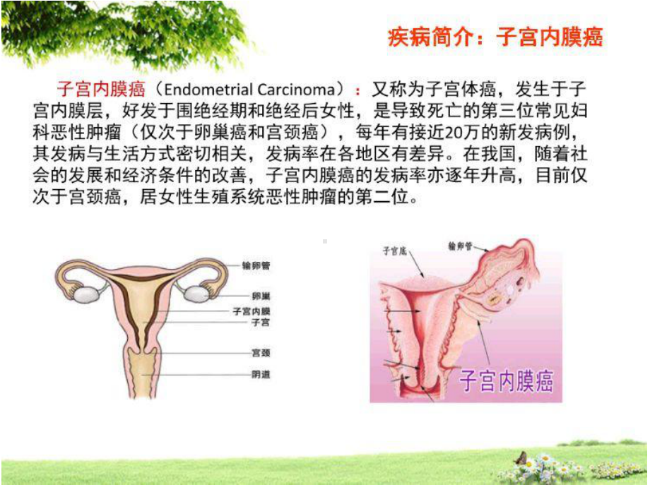 2020子宫内膜癌术后护理PPT课件.ppt_第3页