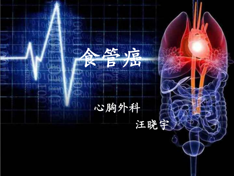 [基础医学]食管癌课件.ppt_第1页