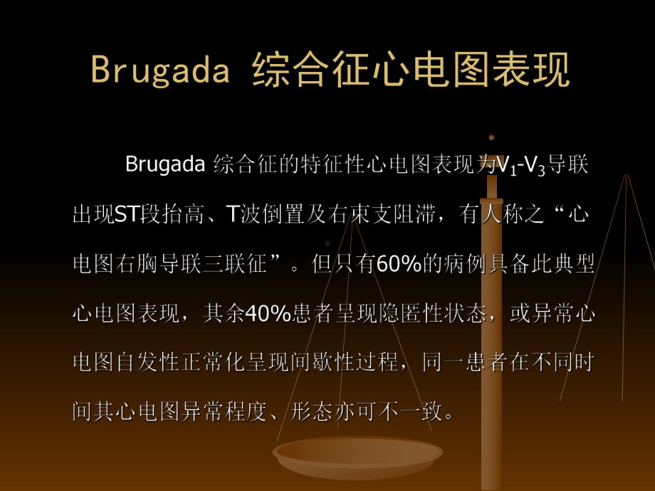 Brugada综合征心电图药物激发试验课件.ppt_第2页