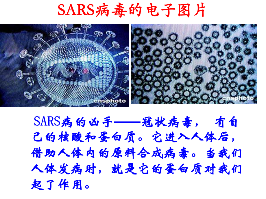 SARS病毒的电子图片课件.ppt_第3页