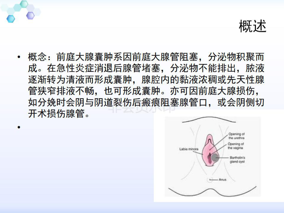 2020前庭大腺囊肿护理PPT课件.ppt_第3页