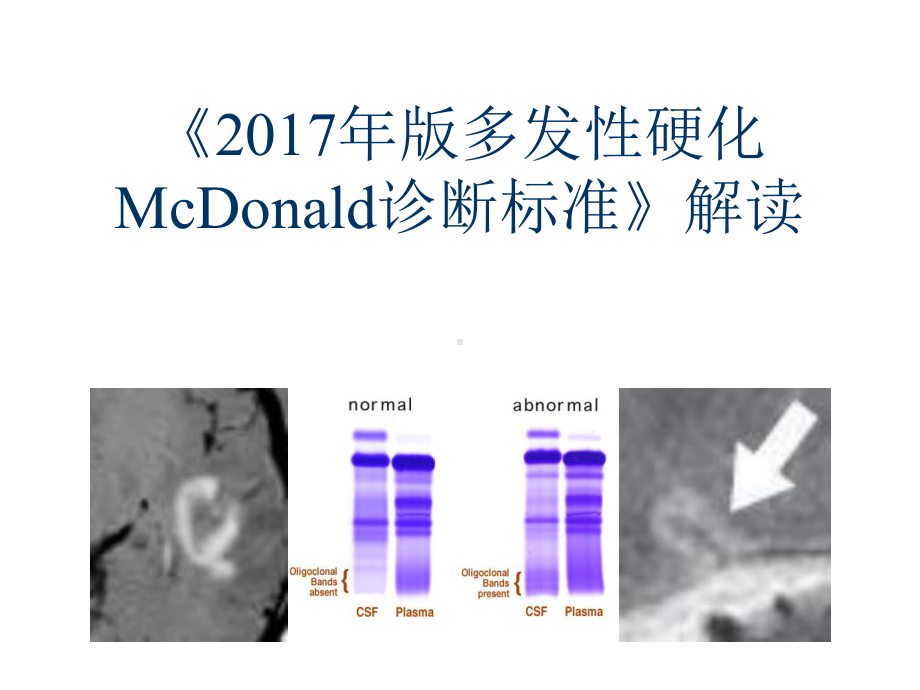 《版多发性硬化McDonald诊断标准》解读课件.ppt_第1页