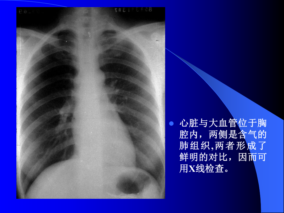 临床医学基础课件：临床循环.ppt_第2页