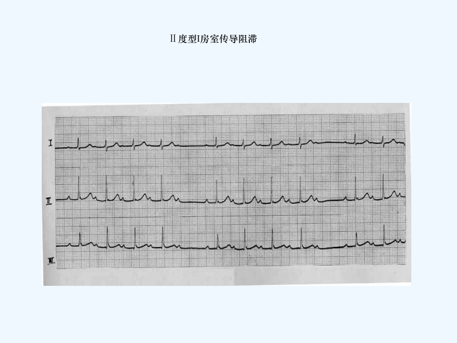 临床执业医师技能考试心电图及影像考试题答案课件.ppt_第2页