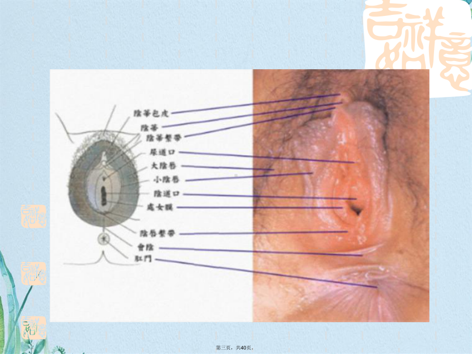 女性外阴肿瘤(共40张)课件.pptx_第3页