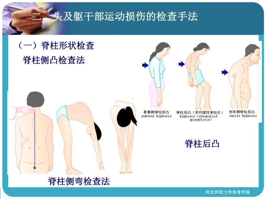 头及躯干部运动损伤课件.ppt_第3页