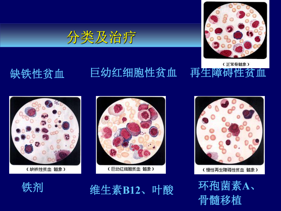 临床药理学-第27章-血液系统疾病的临床用药课件.ppt_第3页