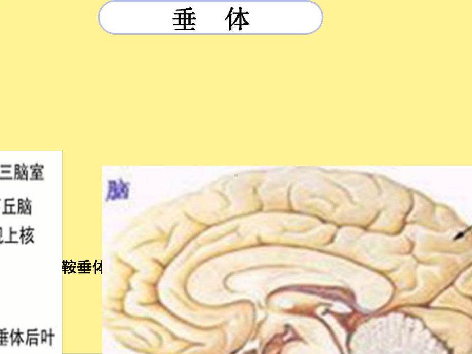 垂体发育异常完整课件.ppt_第3页