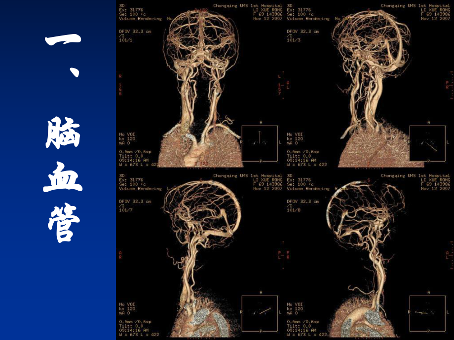 头部三维断层解剖B课件.ppt_第3页