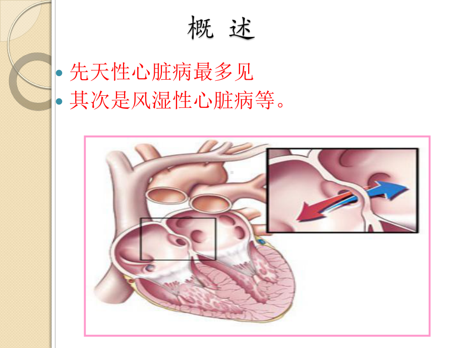 妊娠期合并症(精)(医学PPT课件).ppt_第3页