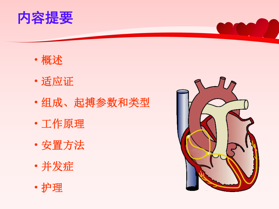 临时起搏器护理解读课件.ppt_第2页