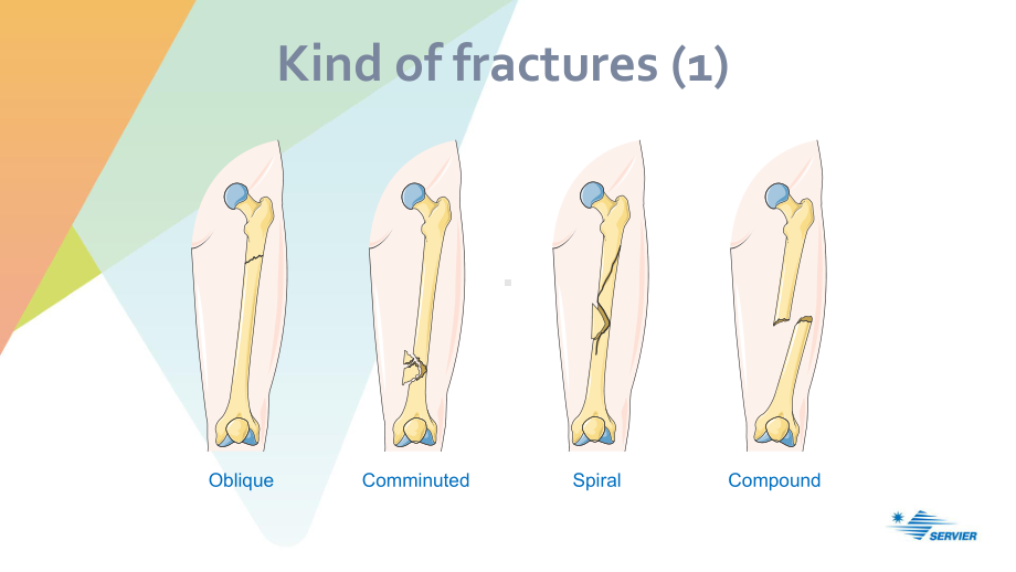 医学科研教学绘图可编辑素材之骨折Bone-fractures课件.ppt_第3页