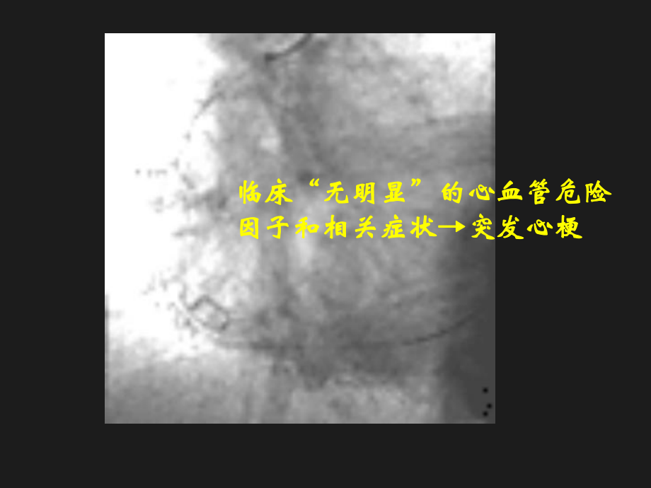 围手术心评估中一讲座课件.ppt_第3页