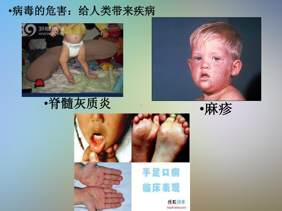 医学病毒和常见致病病毒课件.pptx_第2页