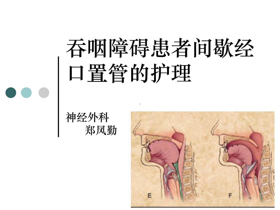 卒中后营养及吞咽困难的管理课件.ppt_第1页