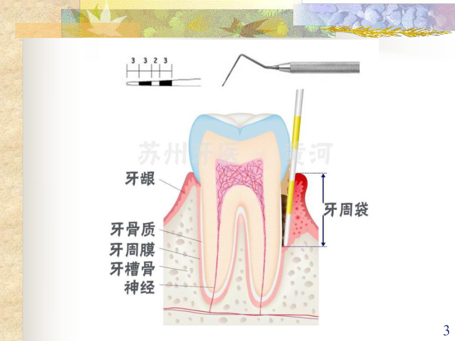 口腔内科学5牙周组织病.课件.ppt_第3页