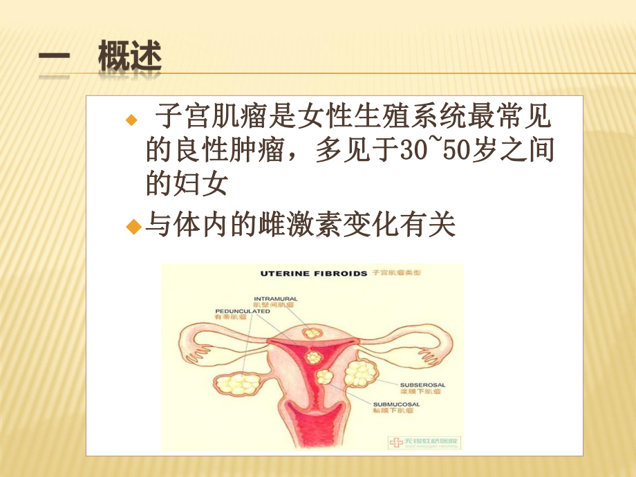 子宫肌瘤及妇科腹部病人的护理课件.ppt_第2页