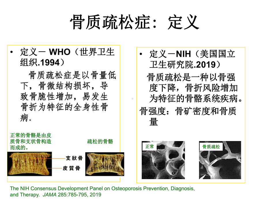 原发性骨质疏松症诊治指南解读课件-PPT.ppt_第3页