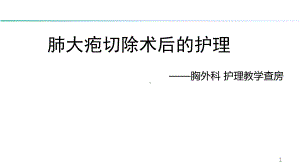 肺大疱切除术后的护理PPT课件.ppt