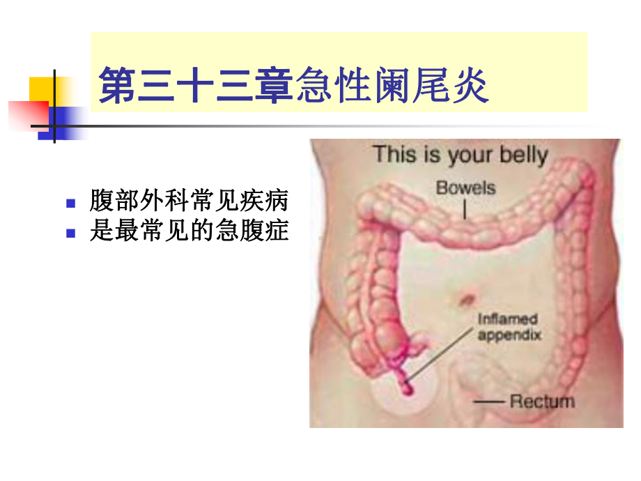 急性阑尾炎精品PPT课件.ppt_第1页