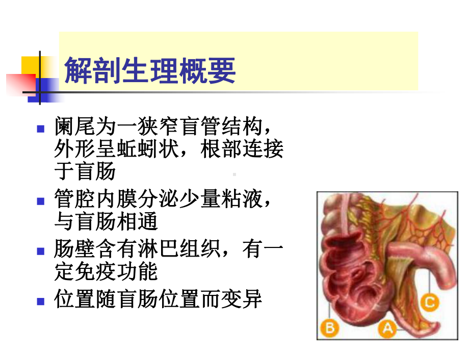 急性阑尾炎精品PPT课件.ppt_第2页