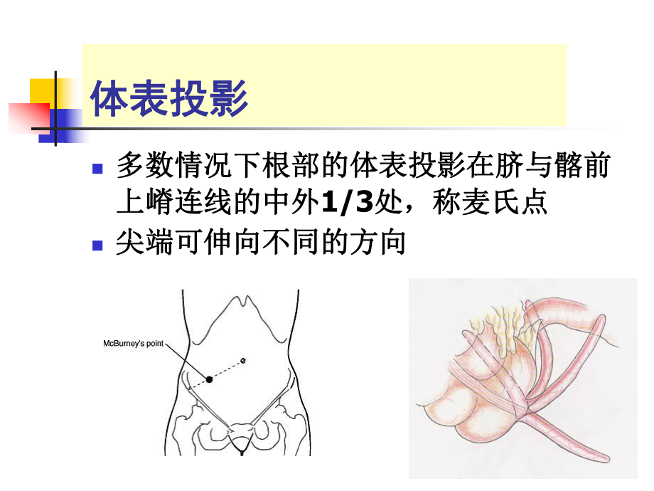 急性阑尾炎精品PPT课件.ppt_第3页