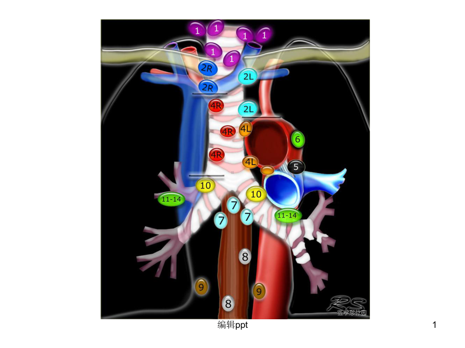 纵隔淋巴结分区1课件.ppt_第1页