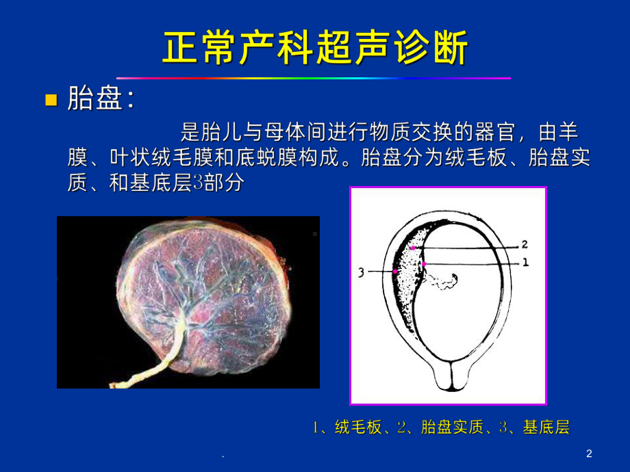 产科急诊超声诊断PPT课件.ppt_第2页