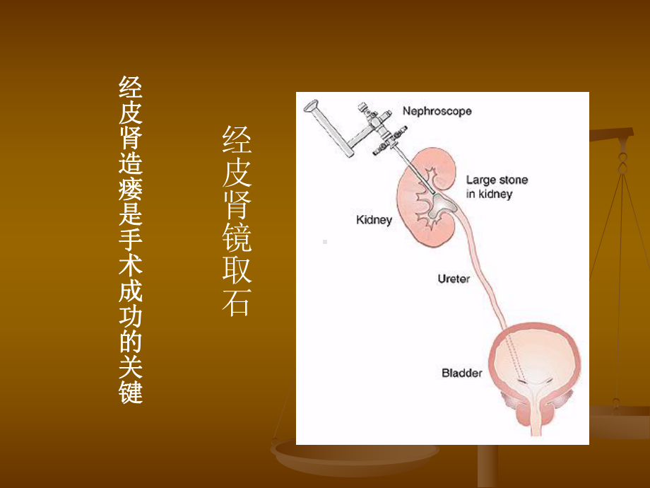 经皮肾镜技术解剖学基础课件.ppt_第2页