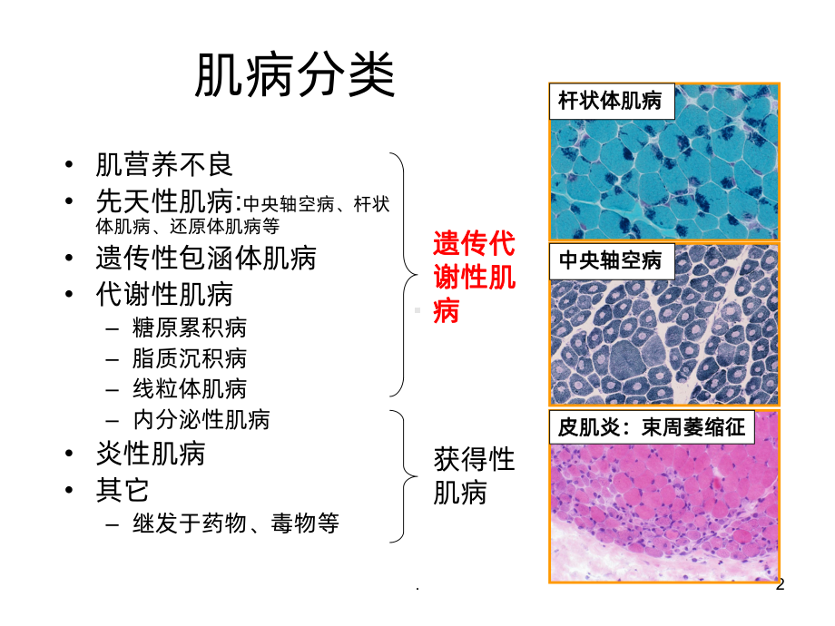 方琪-遗传性肌肉疾病的诊断方法和策略PPT课件.ppt_第2页