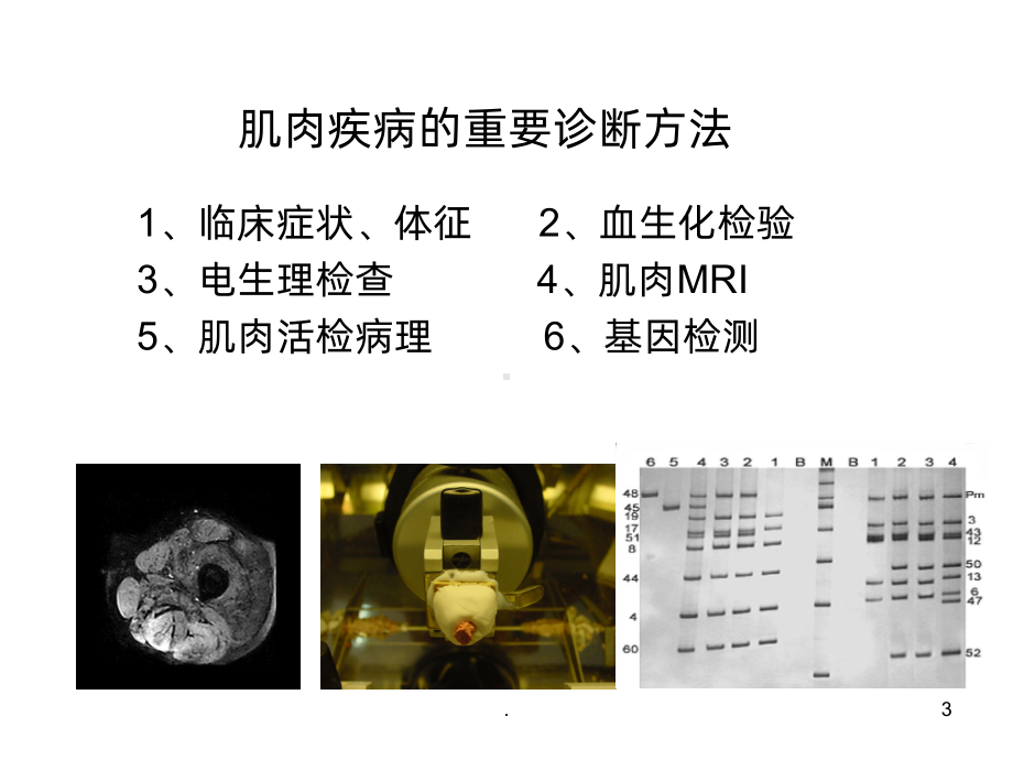 方琪-遗传性肌肉疾病的诊断方法和策略PPT课件.ppt_第3页