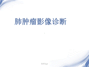 肺肿瘤影像诊断医学PPT课件.ppt