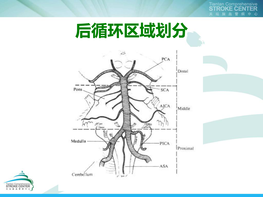 急性后循环梗死的管理PPT课件.ppt_第2页