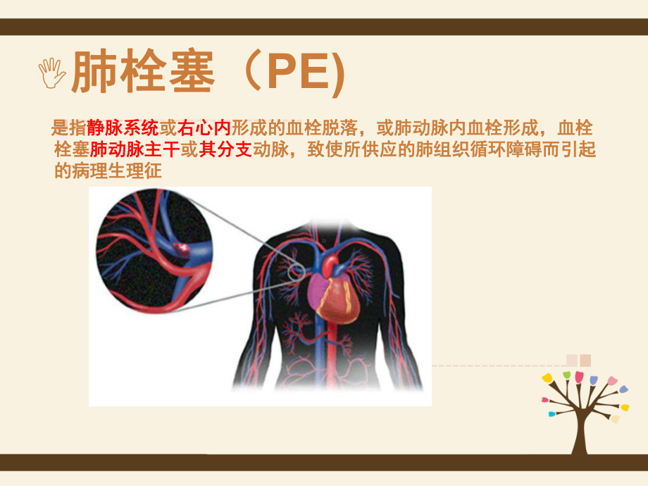 肺栓塞课件ppt课件.ppt_第3页