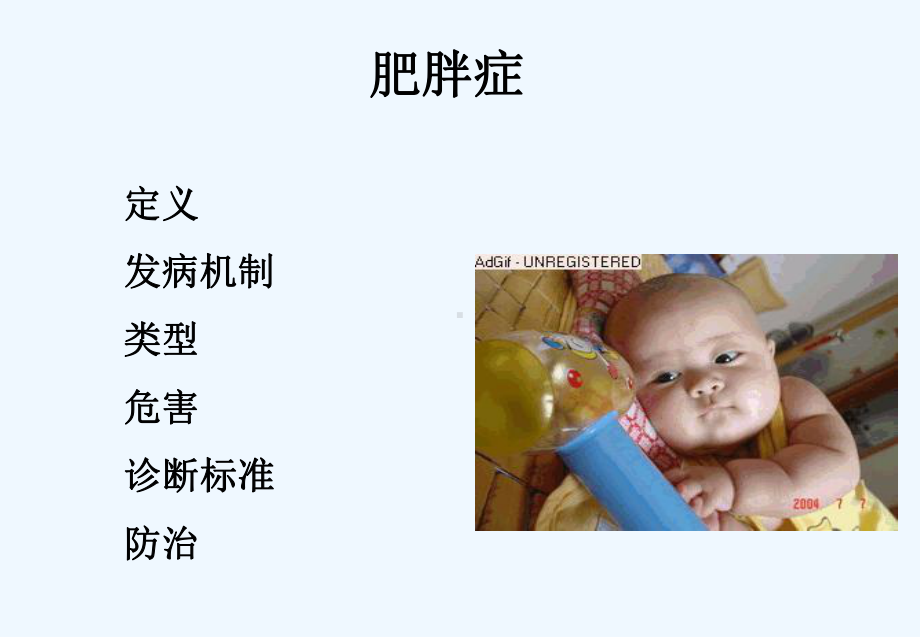 肥胖症-PPT课件.ppt_第2页