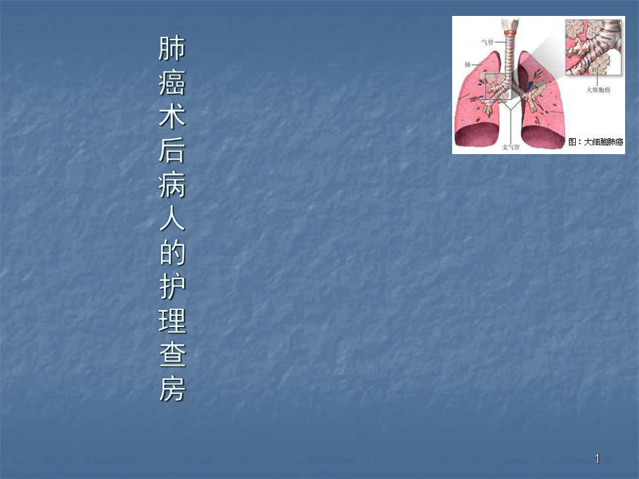 肺癌患者护理查房ppt课件.ppt_第1页