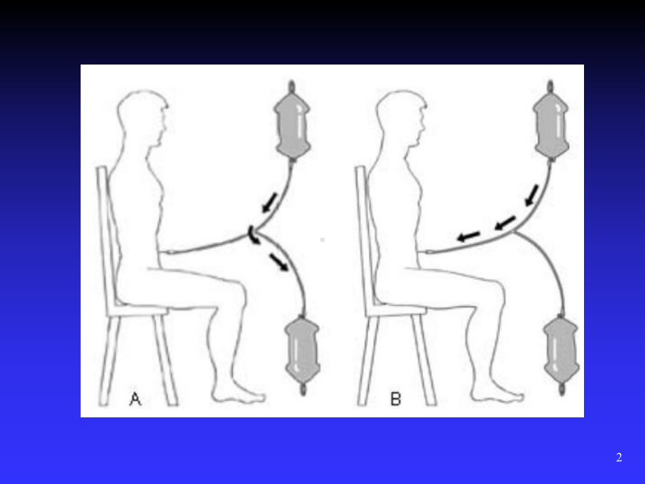 腹膜透析PPT课件.ppt_第2页