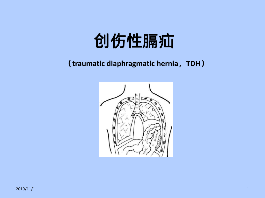 创伤性膈疝PPT课件.ppt_第1页