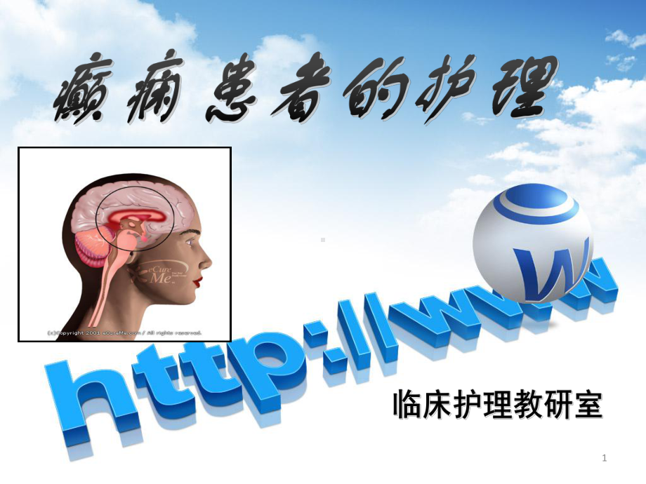 癫痫病人的护理整理ppt课件.ppt_第1页