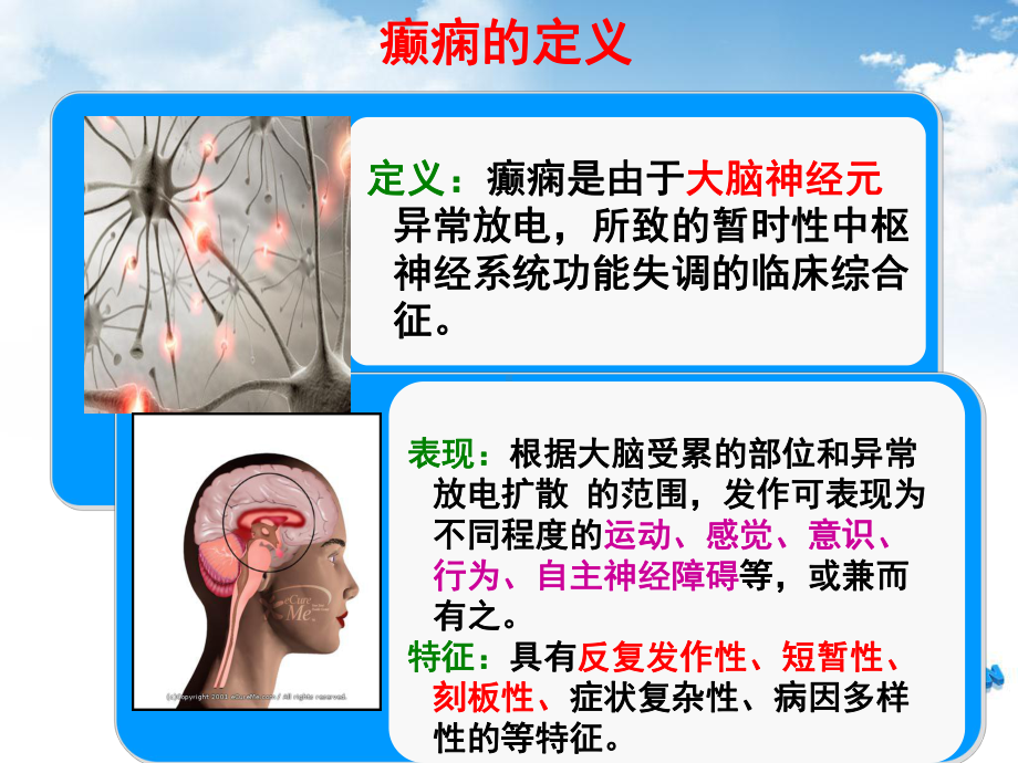 癫痫病人的护理整理ppt课件.ppt_第2页