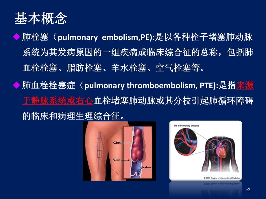 急性肺栓塞诊治及进展PPT课件.ppt_第2页